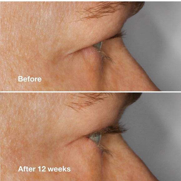 Clinique High Impact Lash Amplifying Serum - Picture 2 of 6